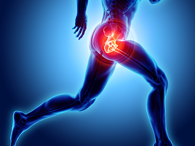 Hip Pain