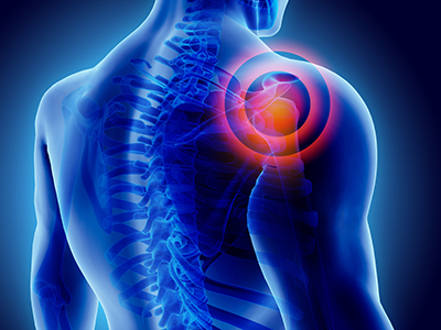 Shoulder Pain
